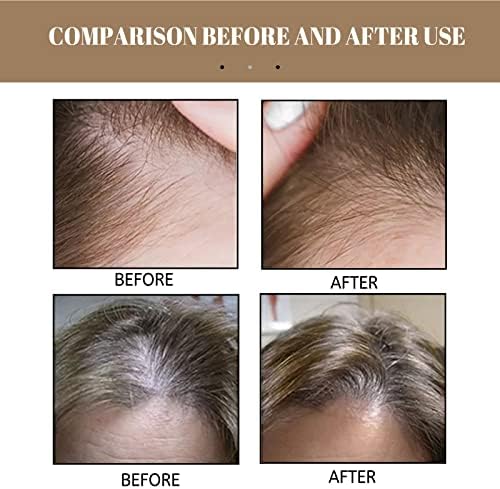 TMTW Rice Shampoo sapun za rast kose, suhi oštećeni sapun za popravak kose za stanjivanje kose i gubitka kose