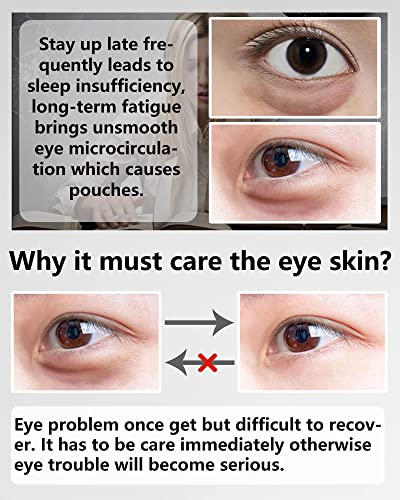 Pod zakrpe za oči - nadograđena maska ​​za oči Crni biser i kolagen, maska ​​za obradu očiju, pod tretmanom za oči, maska ​​za oči